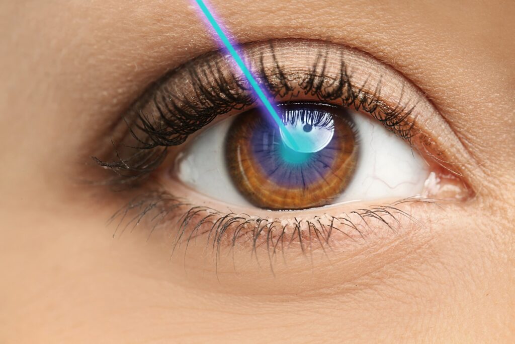 Everything You Can Expect When Getting Laser Eye Surgery