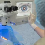 lasik eye surgery